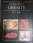 A Colour Atlas Of Obesity by Jung